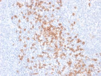 Anti-CD8A (Cytotoxic- & Suppressor T-Cell Marker) Monoclonal Antibody(Clone: rC8/468) Anti-CD8A (Cytotoxic- & Suppressor T-Cell Marker) Monoclonal Antibody(Clone: rC8/468)