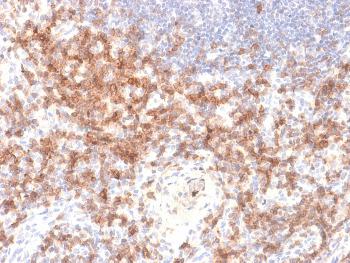 Anti-CD27 (Tumor Necrosis Factor Receptor Superfamily 7) Monoclonal Antibody(Clone: LPFS2/2034R) Anti-CD27 (Tumor Necrosis Factor Receptor Superfamily 7) Monoclonal Antibody(Clone: LPFS2/2034R)