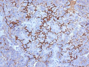 Anti-MUC16 / CA125 (Ovarian Carcinoma Marker) Monoclonal Antibody(Clone: 5E11)