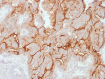 Anti-MUC16 / CA125 (Ovarian Carcinoma Marker) Monoclonal Antibody(Clone: OCA125/2349R) Anti-MUC16 / CA125 (Ovarian Carcinoma Marker) Monoclonal Antibody(Clone: OCA125/2349R)