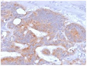 Anti-CD86 (Dendritic Cells Maturation Marker) Monoclonal Antibody(Clone: rC86/1146) Anti-CD86 (Dendritic Cells Maturation Marker) Monoclonal Antibody(Clone: rC86/1146)