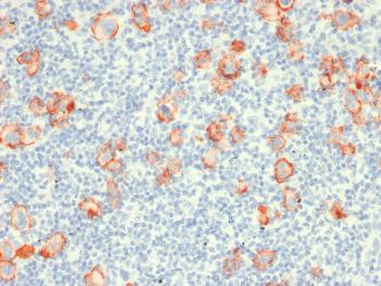 Anti-CD30 / TNFRSF8 (Hodgkin & Reed-Sternberg Cell Marker) Monoclonal Antibody(Clone: rCD30/412) Anti-CD30 / TNFRSF8 (Hodgkin & Reed-Sternberg Cell Marker) Monoclonal Antibody(Clone: rCD30/412)