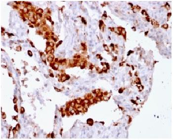 Anti-Napsin A (Lung Adenocarcinoma Marker) Monoclonal Antibody(Clone: rNAPSA/1239) Anti-Napsin A (Lung Adenocarcinoma Marker) Monoclonal Antibody(Clone: rNAPSA/1239)