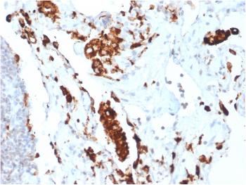Anti-Napsin A (Lung Adenocarcinoma Marker) Monoclonal Antibody(Clone: NAPSA/1865R) Anti-Napsin A (Lung Adenocarcinoma Marker) Monoclonal Antibody(Clone: NAPSA/1865R)