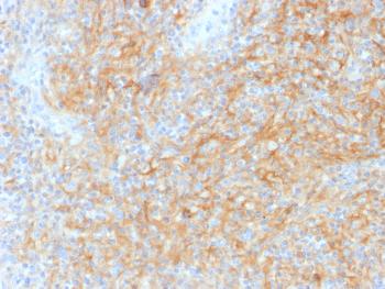 Anti-CD40 / TNFRSF5 / CD40L-Receptor Monoclonal Antibody(Clone: C40/1605)