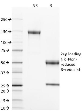 Anti-CD40 / TNFRSF5 / CD40L-Receptor Monoclonal Antibody(Clone: T8P2G4*A6)