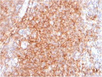 Anti-CD40/ TNFRSF5 / CD40L-Receptor Monoclonal Antibody(Clone: C40/2383)