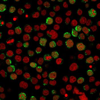 Fig. 3: Immunofluorescent staining of paraformaldehyde-fixed Jurkat cells using CD40L Mouse Monoclonal Antibody (CD40LG/2761) followed by goat anti-Mouse IgG conjµgated to CF488 (green). Nuclei are stained with Reddot.