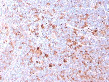 Fig. 5: Formalin-fixed, paraffin-embedded human Tonsil stained with CD40L-Monospecific Mouse Monoclonal Antibody (CD40LG/2761).