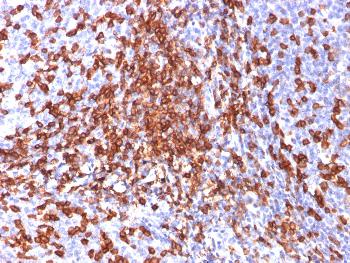 Anti-CD44 / HCAM Std. (Cancer Stem Cell Marker) Monoclonal Antibody(Clone: 156-3C11) Anti-CD44 / HCAM Std. (Cancer Stem Cell Marker) Monoclonal Antibody(Clone: 156-3C11)