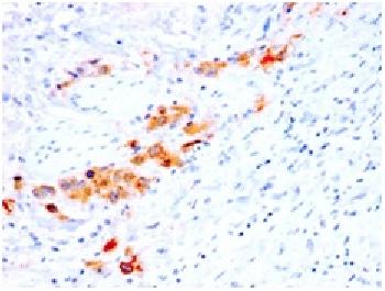 Anti-CD44v4 (Marker of Tumor Metastasis) Monoclonal Antibody(Clone: rCD44v4/1219) Anti-CD44v4 (Marker of Tumor Metastasis) Monoclonal Antibody(Clone: rCD44v4/1219)