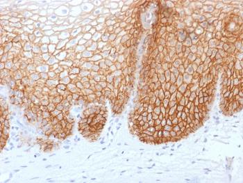 Anti-CD44v9 (Marker of Tumor Metastasis) Monoclonal Antibody(Clone: rCD44v9/1459) Anti-CD44v9 (Marker of Tumor Metastasis) Monoclonal Antibody(Clone: rCD44v9/1459)