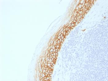Anti-CD44v9 (Marker of Tumor Metastasis) Monoclonal Antibody(Clone: CD44v9/2344R) Anti-CD44v9 (Marker of Tumor Metastasis) Monoclonal Antibody(Clone: CD44v9/2344R)