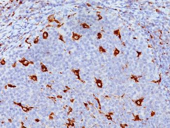 Anti-CD68 (Macrophage Marker) Monoclonal Antibody(Clone: KP1) Anti-CD68 (Macrophage Marker) Monoclonal Antibody(Clone: KP1)