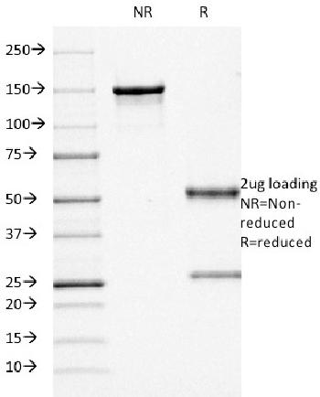 Anti-CD68 (Macrophage Marker) Monoclonal Antibody(Clone: KP1) Anti-CD68 (Macrophage Marker) Monoclonal Antibody(Clone: KP1)