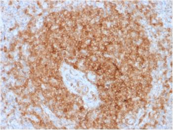 Anti-CD79a (B-Cell Marker) Monoclonal Antibody(Clone: rIGA/764) Anti-CD79a (B-Cell Marker) Monoclonal Antibody(Clone: rIGA/764)