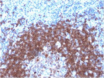 Anti-CD79a (B-Cell Marker) Monoclonal Antibody(Clone: IGA/1790R) Anti-CD79a (B-Cell Marker) Monoclonal Antibody(Clone: IGA/1790R)
