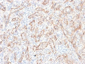Anti-TNFS15 / VEGI (Vascular Endothelial Growth Inhibitor) Monoclonal Antibody(Clone: rVEGI/1283) Anti-TNFS15 / VEGI (Vascular Endothelial Growth Inhibitor) Monoclonal Antibody(Clone: rVEGI/1283)