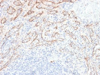 Anti-TNFS15 / VEGI (Vascular Endothelial Growth Inhibitor) Monoclonal Antibody(Clone: VEGI/2052R) Anti-TNFS15 / VEGI (Vascular Endothelial Growth Inhibitor) Monoclonal Antibody(Clone: VEGI/2052R)