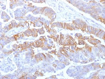Anti-E-Cadherin (CDH1) / CD324 (Intercellular Junction Marker) Monoclonal Antibody(Clone: rCDH1/1525) Anti-E-Cadherin (CDH1) / CD324 (Intercellular Junction Marker) Monoclonal Antibody(Clone: rCDH1/1525)
