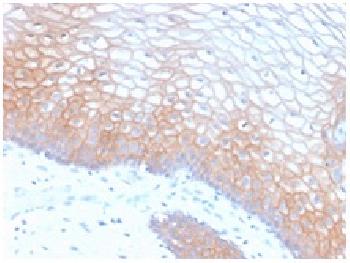 Anti-E-Cadherin (CDH1) / CD324 (Intercellular Junction Marker) Monoclonal Antibody(Clone: CDH1/2208R) Anti-E-Cadherin (CDH1) / CD324 (Intercellular Junction Marker) Monoclonal Antibody(Clone: CDH1/2208R)