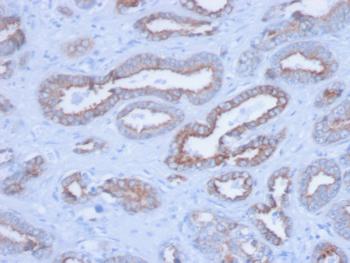 Anti-Cytokeratin, pan (Epithelial Marker) Monoclonal Antibody(Clone: PCK/3150)