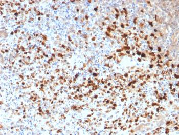 Anti-HSV1 (Herpes Simplex Virus Type I) Monoclonal Antibody(Clone: HSV1/1934) Anti-HSV1 (Herpes Simplex Virus Type I) Monoclonal Antibody(Clone: HSV1/1934)