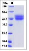 Mouse CD63 / Tspan-30 / Tetraspanin-30 Recombinant Protein (Fc Tag, ECD)(Discontinued)