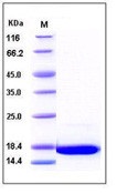 Human aFGF / FGF1 Recombinant Protein(Discontinued)