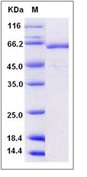Mouse TLR2 Recombinant Protein (His Tag)(Discontinued)