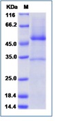 Human CD70 / CD27L / TNFSF7 Recombinant Protein (mFc Tag)