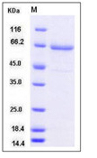 Recombinant human TLR2 protein with C-terminal His tag (extracellular domain Met 1-Arg 587)(Discontinued)
