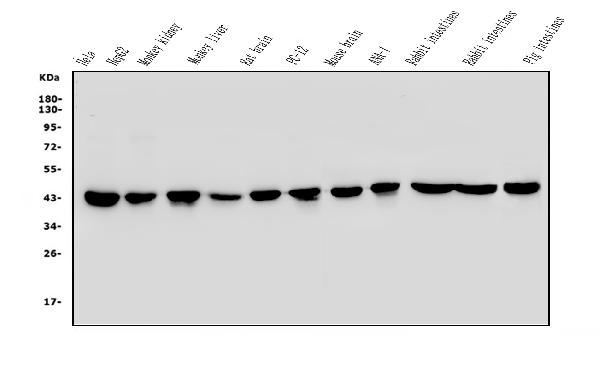 Figure 1. Western blot analysis of beta-Actin using anti-beta-Actin antibody. Electrophoresis was performed on a 5-20% SDS-PAGE gel at 70V (Stacking gel) / 90V (Resolving gel) for 2-3 hours. The sample well of each lane was loaded with 50µg of sample under reducing conditions. Lane 1: human Hela whole cell lysates, Lane 2: human HepG2 whole cell lysates, Lane 3: monkey kidney tissue lysates, Lane 4: monkey liver tissue lysates, Lane 5: rat brain tissue lysates, Lane 6: rat PC-12 whole cell lysates, Lane 7: mouse brain tissue lysates, Lane 8: mouse ANA-1 whole cell lysates, Lane 9: rabbit intestine tissue lysates, Lane 10: rabbit intestine tissue lysates, Lane 11: pig intestine tissue lysates.