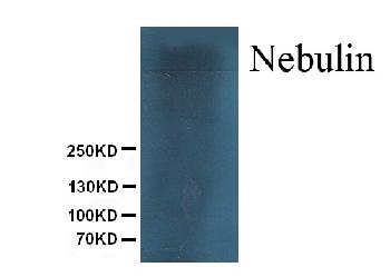 Anti-Nebulin Monoclonal Antibody (Clone: NB2)