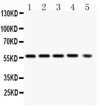 Anti-PKB alpha Monoclonal Antibody (Clone: PKB-175)