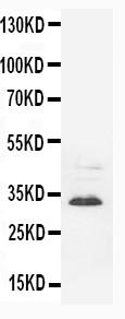 Anti-Synaptophysin Monoclonal Antibody (Clone: SVP-38)