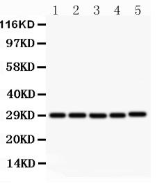 Figure 1: Anti-CD40L antibody(39-2038). Western blotting: Lanes: Anti CD40L(39-2038) at 0.5ug/ml, Lane 1: MCF-7 Whole Cell Lysate at 40ug,  Lane 2: HELA Whole Cell Lysate at 40ug, Lane 3: JURKAT Whole Cell Lysate at 40ug, Lane 4: HMY2 Whole Cell Lysate at 40ug, Lane 5: COLO320 Whole Cell Lysate at 40ug. Predicted band size: 29 kDa. Observed band size: 29 kDa.