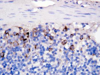 Figure 2: Anti CD40 Lantibody(39-2038). IHC(P): Rat Intestine Tissue.