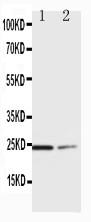 Anti-SOCS1 Polyclonal Antibody