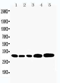 Figure 1: Anti-Caspase-3 antibody(39-2098). Western blotting : Lane 1: Rat Liver Tissue Lysate, Lane 2: Rat Thymus Tissue Lysate, Lane 3: Rat Spleen Tissue Lysate, Lane 4: HEPA Cell Lysate, Lane 5: NEURO Cell Lysate.