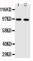 Figure 1: Anti-TLR4 antibody(39-2114). Western blotting: Lane 1: HELA Cell Lysate , Lane 2: SMMC Cell Lysate.