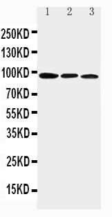 Figure 1: Anti-AHR antibody(39-2135). Western blotting: Lane 1: Mouse Brain Tissue Lysate, Lane 2: Mouse Heart Tissue Lysate, Lane 3: Mouse Liver Tissue Lysate.