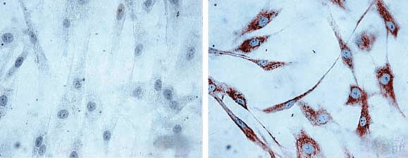 Figure 5 :  Mouse Anti-Hsp60 Antibody [LK1,] used in Immunocytochemistry/Immunofluorescence (ICC/IF) on Human skin Fibroblasts