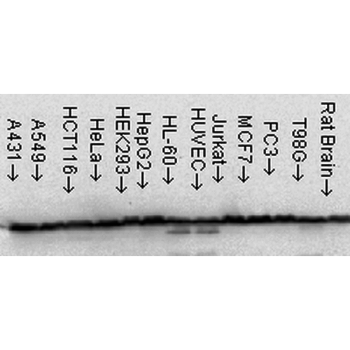 Figure 3 :  Mouse Anti-Hsp60 Antibody [LK-1] used in Western Blot (WB) on Human Cell line lysates