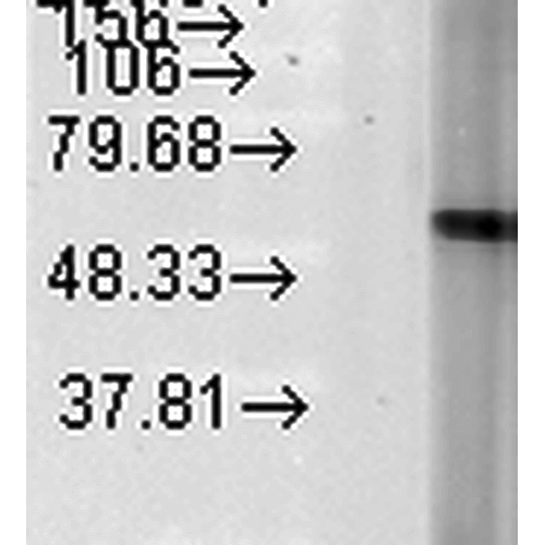 Figure 3 :  Mouse Anti-Hsp60 Antibody [LK-2] used in Western Blot (WB) on Human Heat Shocked HeLa cell lysates