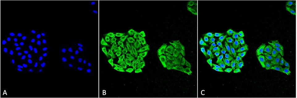 Figure1 : Mouse Anti-HSP70 Antibody [3A3] used in Immunocytochemistry/Immunofluorescence (ICC/IF) on Human Cervical Cancer cell line (HeLa)