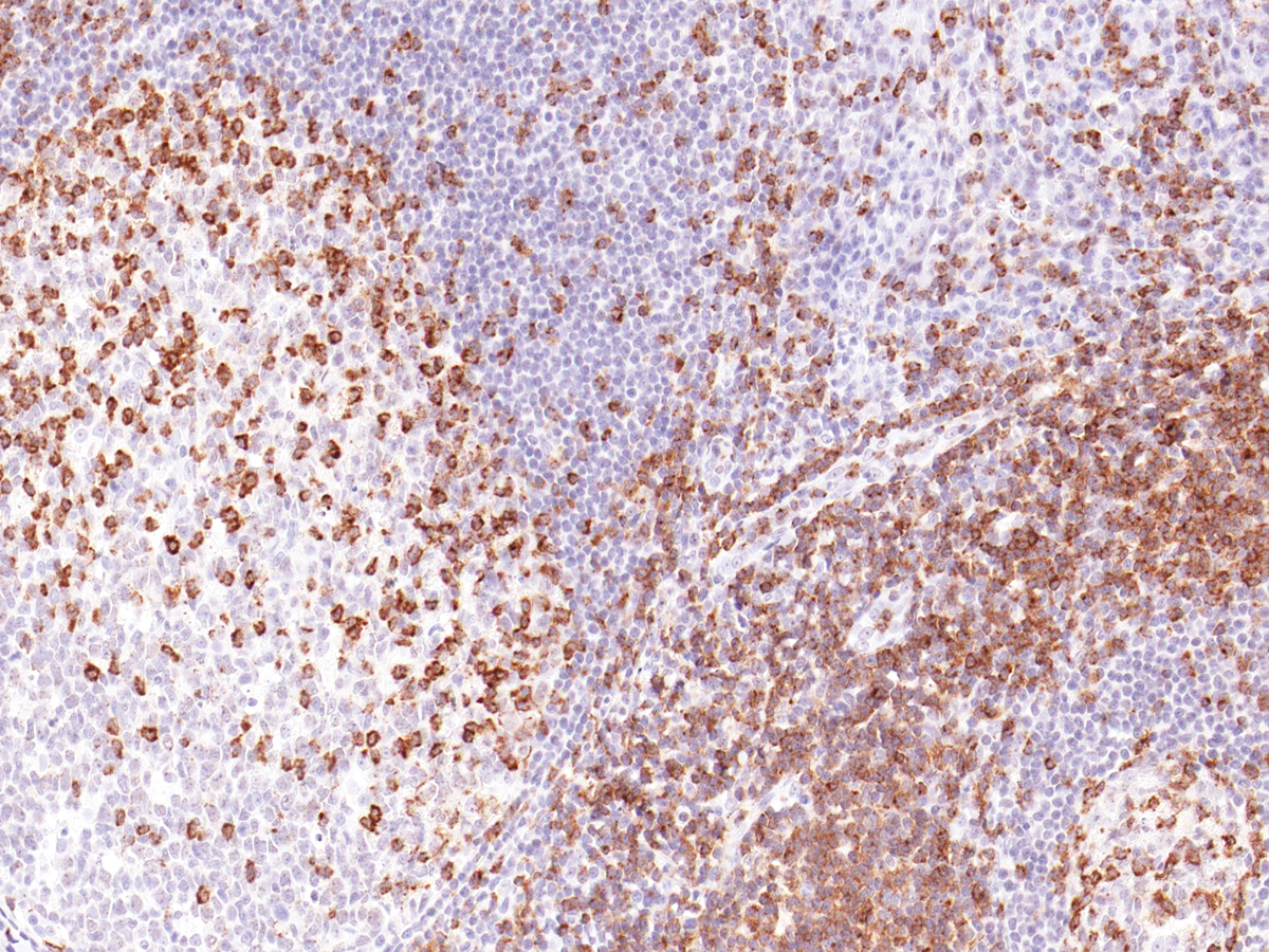 Anti-CD2 Monoclonal Antibody (Clone:IHC531)-Ready to Use(Discontinued)