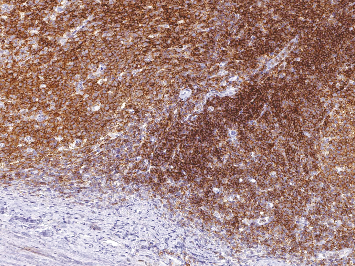 Anti-CD45 (LCA) Monoclonal Antibody (Clone:IHC045)