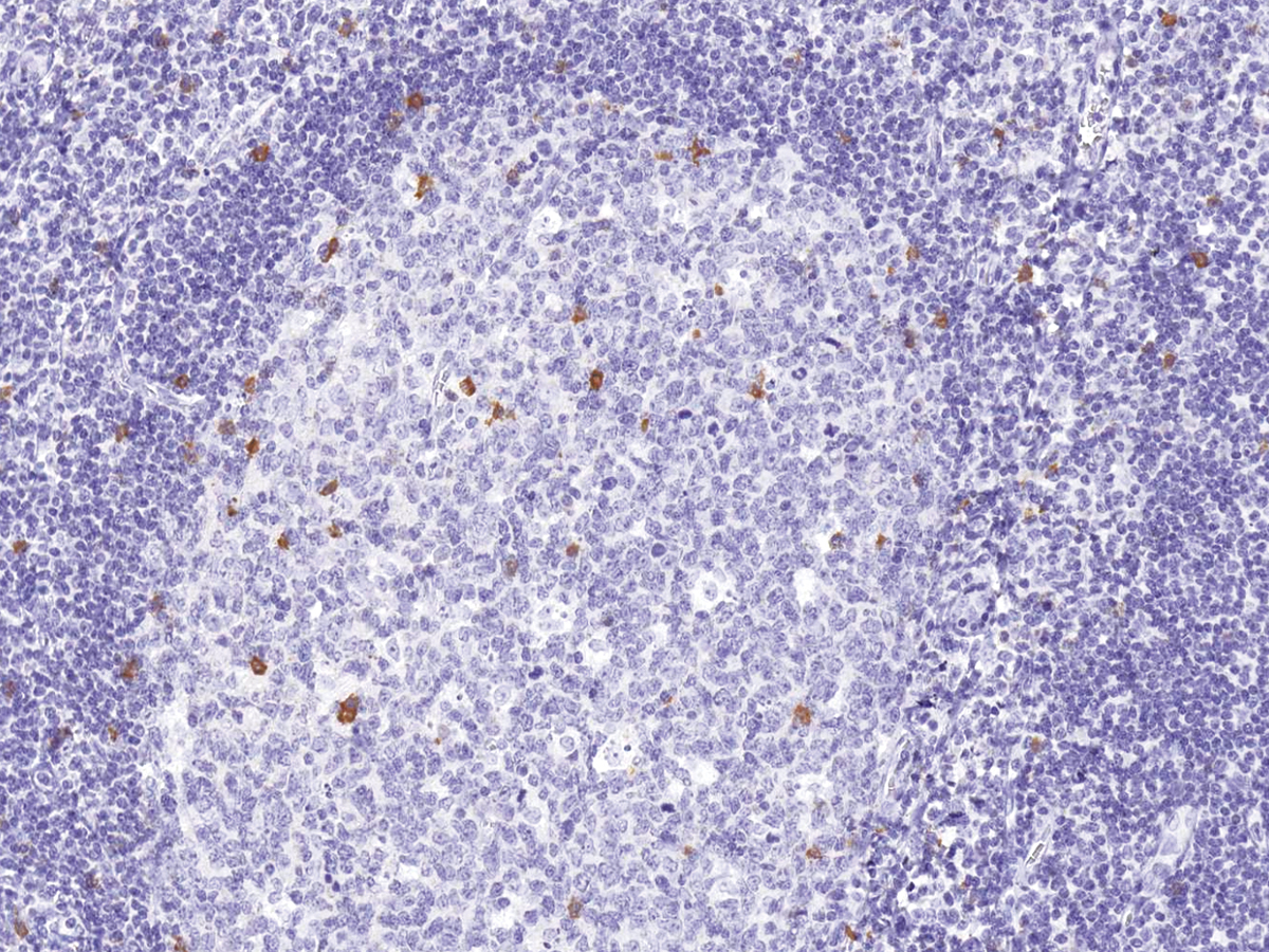 Anti-CD57 Monoclonal Antibody (Clone:IHC539)