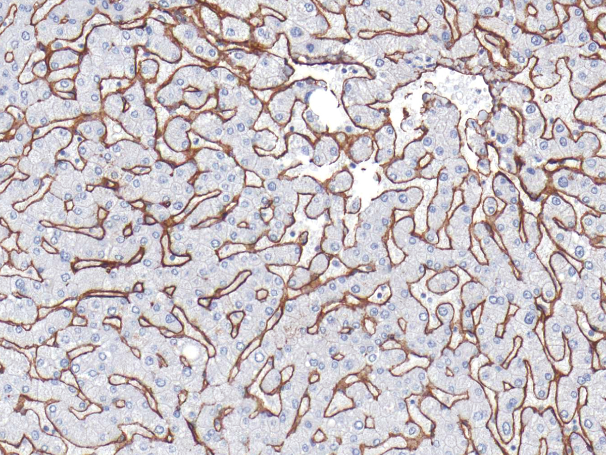 Anti-Collagen Type IV Monoclonal Antibody (Clone:IHC549)